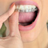 caseros eficaces para blanquear los dientes
