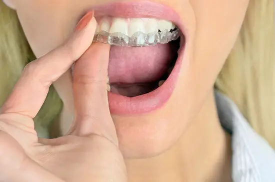 caseros eficaces para blanquear los dientes